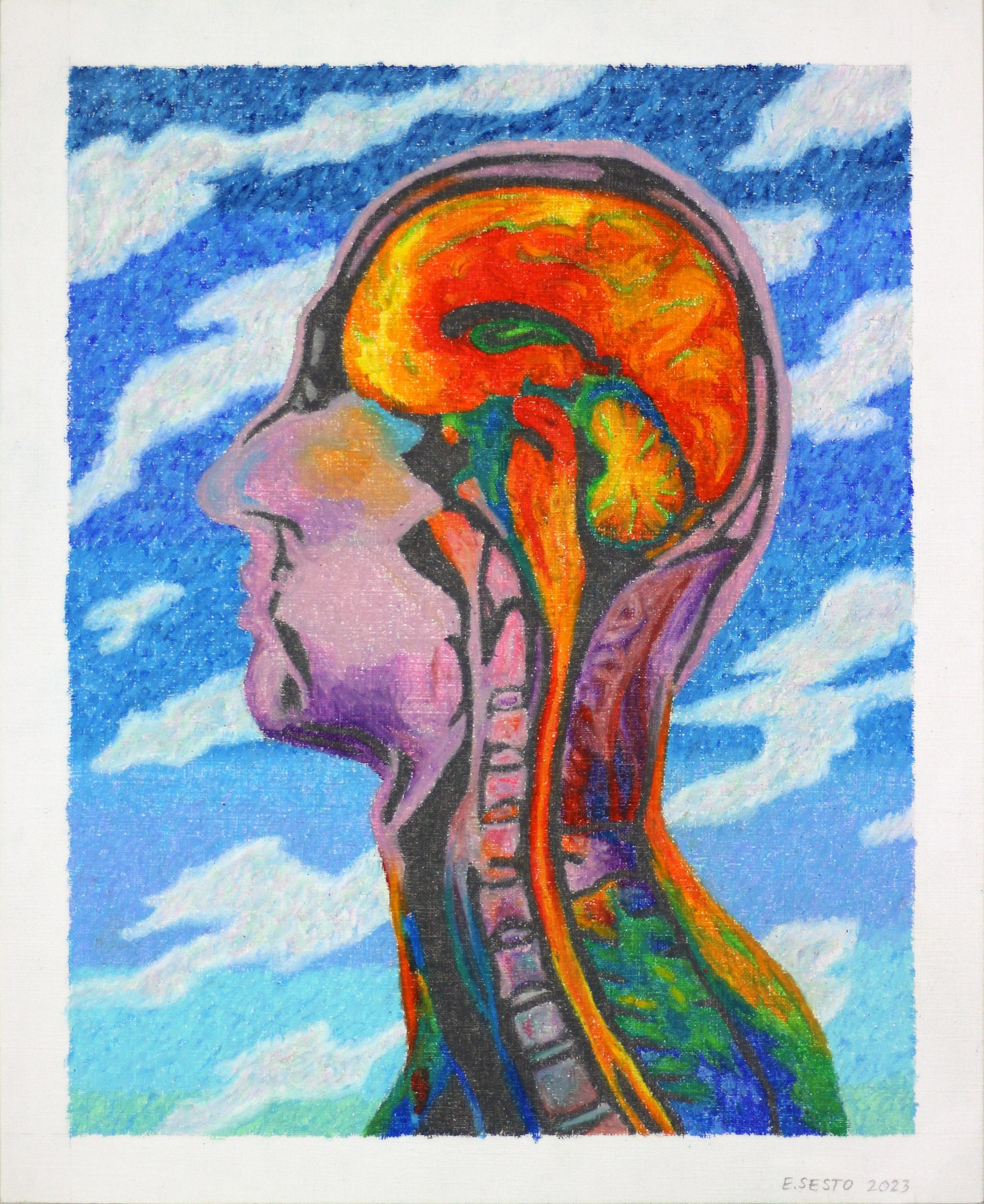 Eric Sesto_neurodiversity